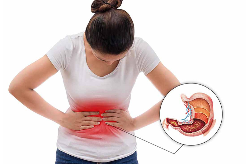 Đau bụng âm ỉ là triệu chứng điển hình của đau dạ dày cấp